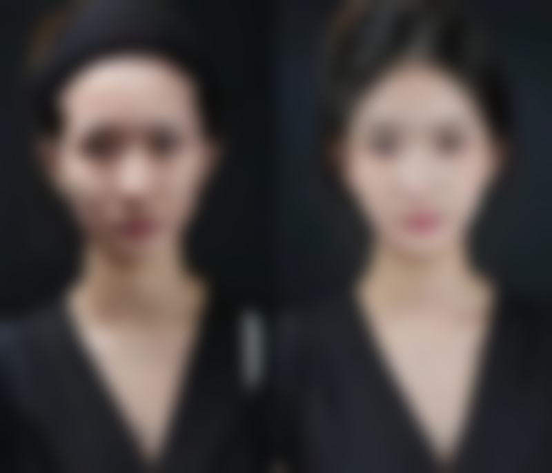 六、抚顺聚美颜医疗美容诊所价格表：（仅供参考）