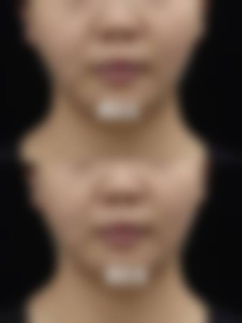 七、湖州南林美之匠整形医院真实的顾客评价如下：