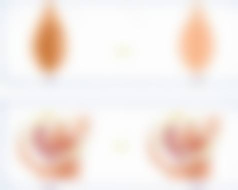 五、天津美津（美中）宜和妇儿医院医疗美容中 心实例：