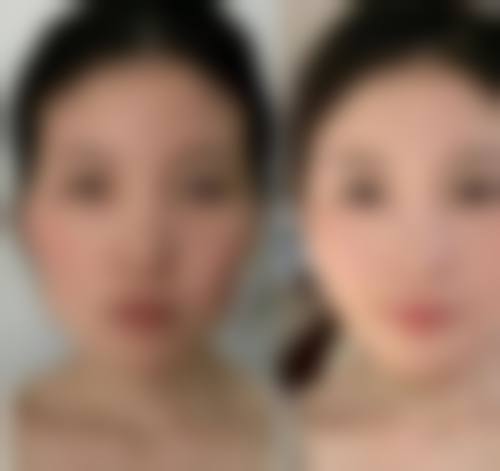 四、湖州南林美之匠整形医院实例