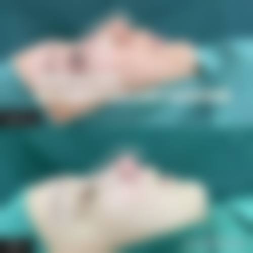 六、福州周江衡爱凝隆美尔整形医院怎么预约：