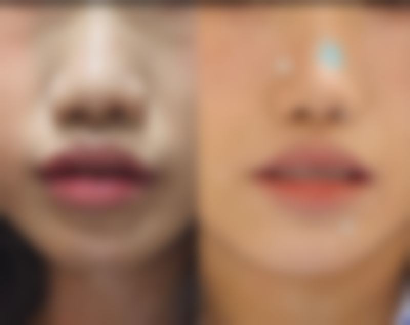 八、福州周江衡爱凝隆美尔整形医院真实的顾客评价如下：