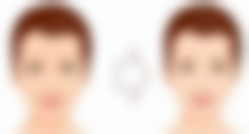 怎样更有效去眼袋？男士去眼袋专属改善方案来啦