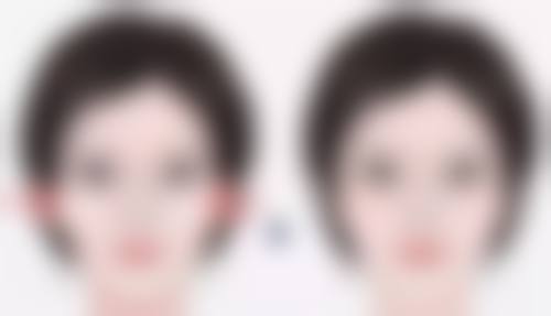 怎样更有效地去除眼袋？分型定制方案+多法结合，让你告别熊猫眼重拾亮眼风采