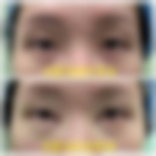 四、北京尚美整形医疗美容医院实例