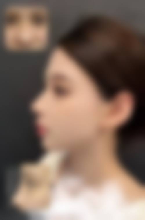 七、北京尚美整形医疗美容医院真实的顾客评价如下：