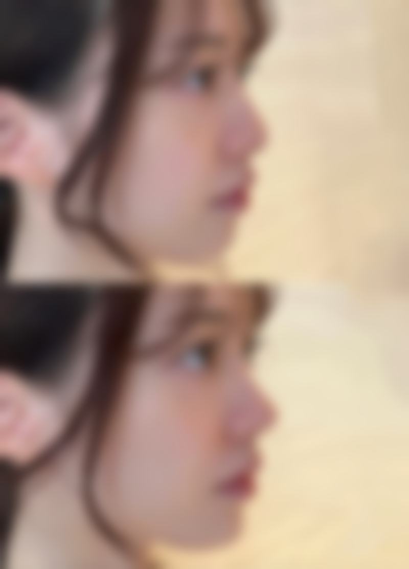 八、南宁南国妇产医院整形美容科真实的顾客评价如下：