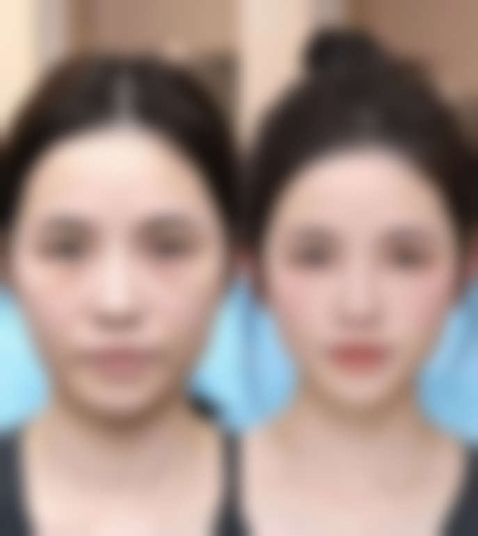 六、南宁南国妇产医院整形美容科怎么预约：