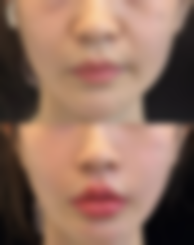 八、牡丹江亮脸医疗美容门诊部真实的顾客评价如下：