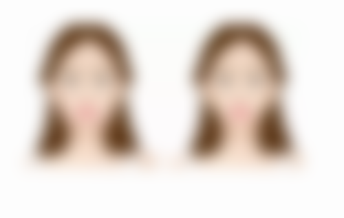 丰太阳穴选什么方法好？胶原蛋白注射的再生功效