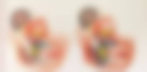 割完双眼皮后何时能碰水洗脸？多版本时间建议及护理要点助你安心恢复 