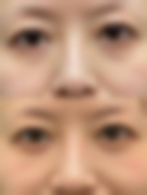 七、北京柏荟非凡整形医院价格表：（仅供参考）