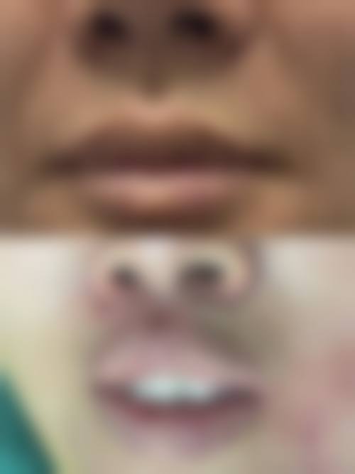 五、北京柏荟非凡整形医院实例