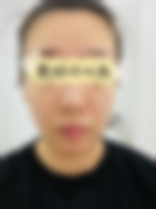 四、长沙优艺谋医疗美容诊所可开展整形美容项目