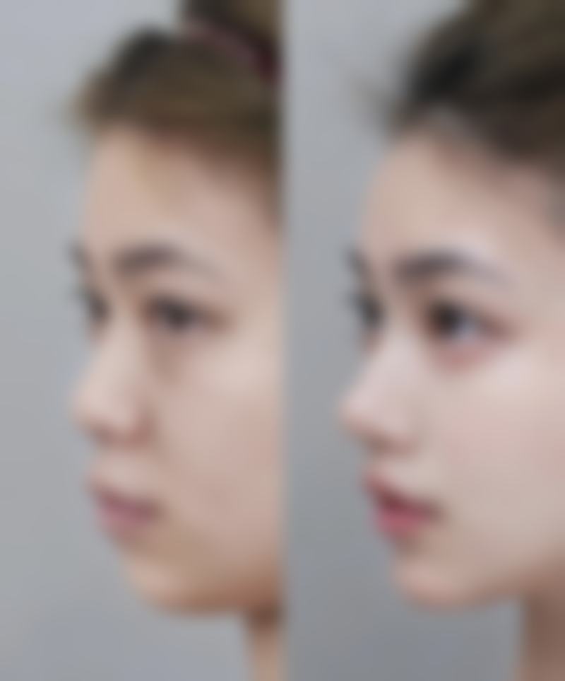 六、兰州军区兰州总医院怎么预约：