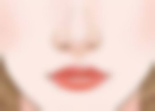 双眼皮术后俩月肉条：改善处理之物理与手术修复