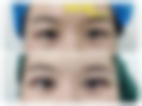 六、莆田水润木医疗美容门诊部怎么预约：