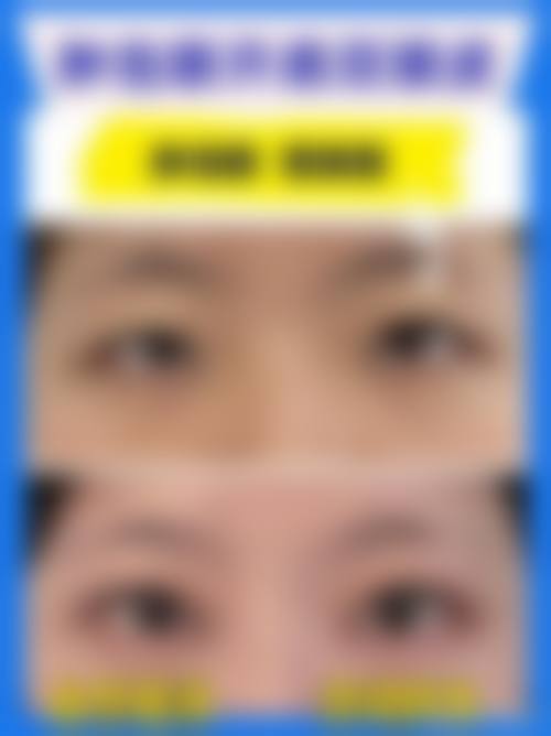 五、蚌埠怀远上和医院医学美容中 心实例