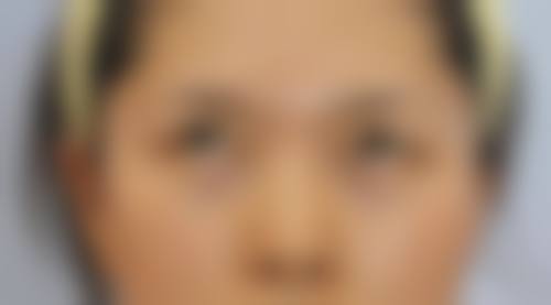 八、墨江容貌肌因整形医院真实的顾客评价如下：