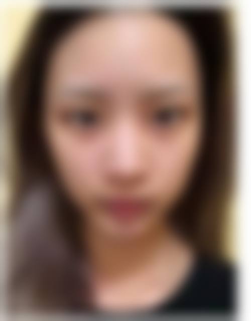 六、韩国Chiu整形外科价格表：（仅供参考）