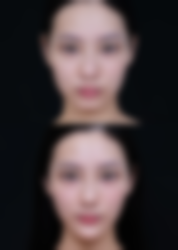 七、韩国PVN整形外科价格表：（仅供参考）