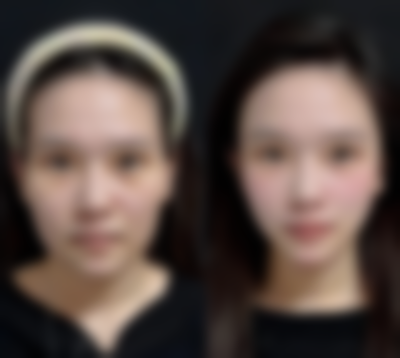 六、韩国PVN整形外科怎么预约：