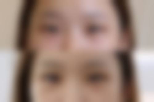 八、韩国CHO I 整形外科真实的顾客评价如下：