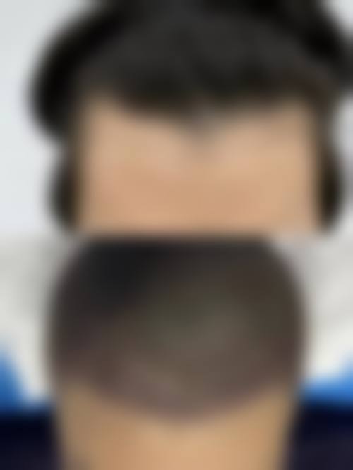 五、沈阳和颜整形医院实例