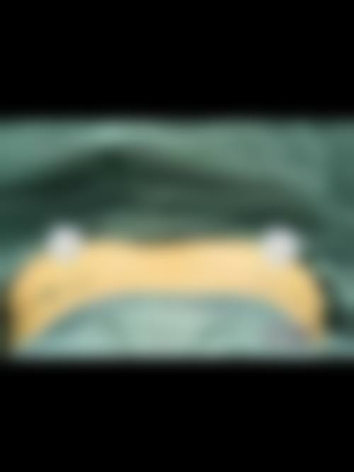 七、韩国波轮美volume整形医院价格表：（仅供参考）