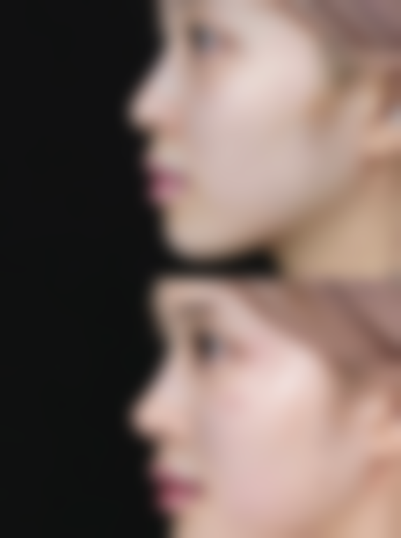 蛋清加蜂蜜去眼袋的作用原理大揭秘