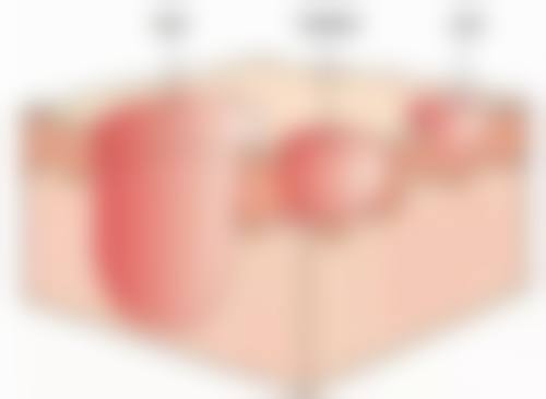 任善美医生在哪家医院怎么预约？