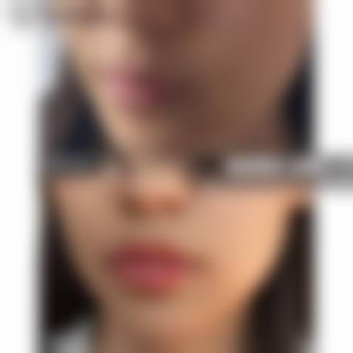 七、河南郑州美昂整形价格表：（仅供参考）