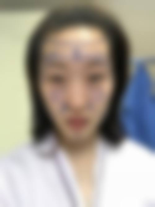 五、克拉玛依曼丽整形医疗美容诊所实例