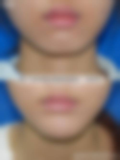 七、克拉玛依曼丽整形医疗美容诊所价格表:(仅供参考)