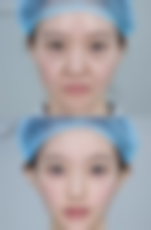 五、北京精艺吉美医疗美容医院实例