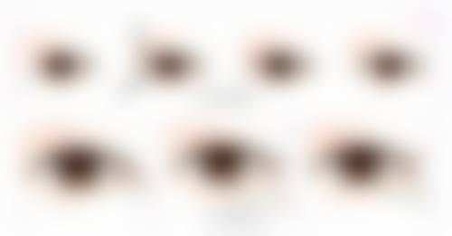 双眼皮拆线后眼角小疙瘩的积极意义与修复展望