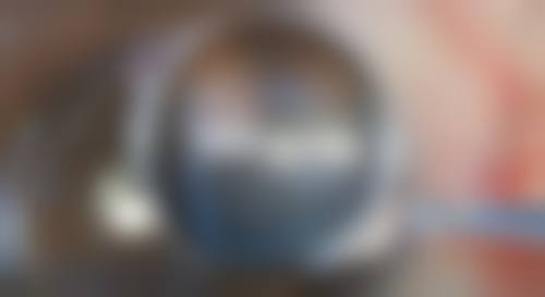 了解瘢痕体质疤痕增生期时长