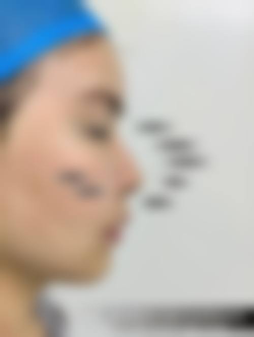 五、青岛心美眼医疗整形美容诊所实例