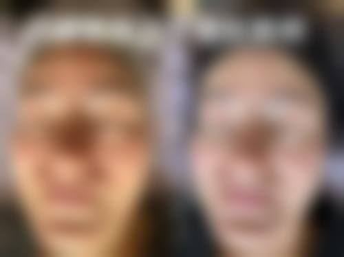 八、吉安德尔美客医疗美容门诊部真实的顾客评价如下: