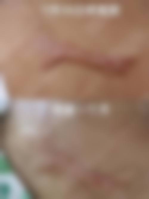胡瑞斌医生项目价格表参考