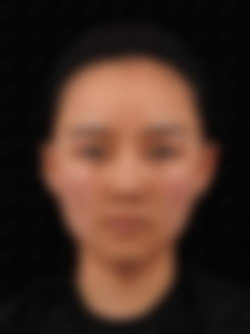 八、漳州新生植发医疗美容诊所真实的顾客评价如下：