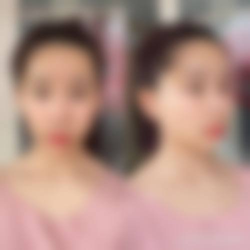 六、漳州新生植发医疗美容诊所怎么预约：