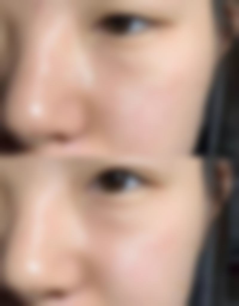 五、西安允朵医疗美容门诊部怎么预约: