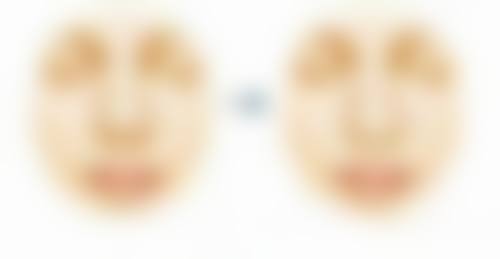 假体隆胸移位啥感觉？其他伴随症状大解析