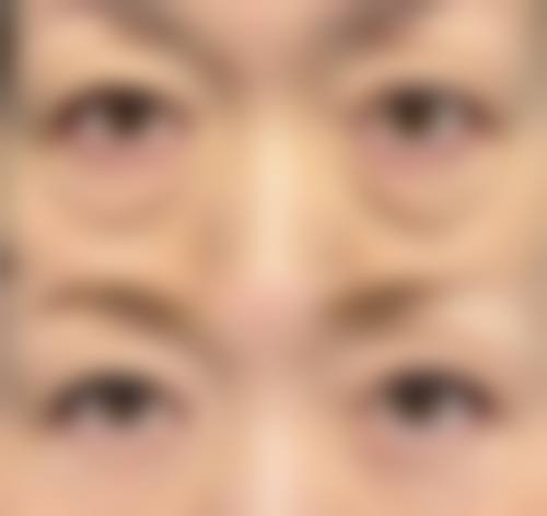 五、合肥大韩整形美容医院实例