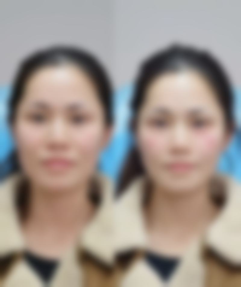 五、钦州槎城华美医疗美容诊所实例