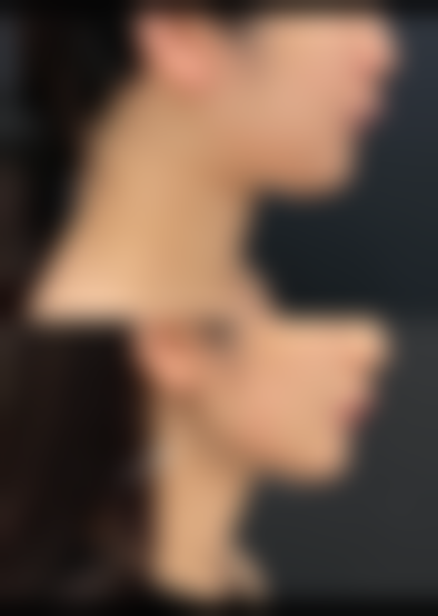 四、常州东美整形医院实例