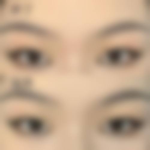 八、六盘水雅典娜美容整形外科诊所真实的顾客评价如下：