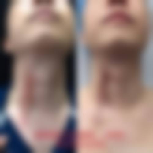 林伟华医生实例