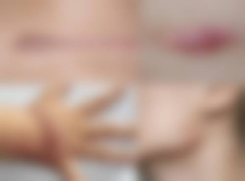 林伟华医生口碑和评价